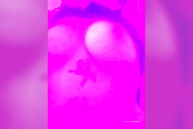Hot Titty Flash! Therealbritain Rips Her Top To Expose Her Perfect Boobs